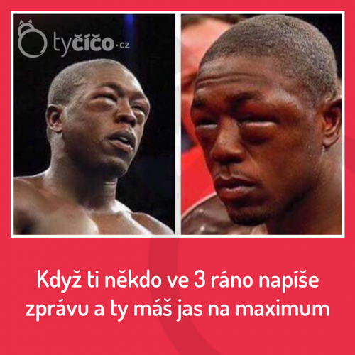  Moje oči! 