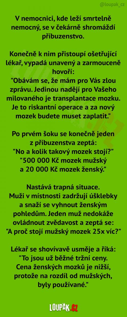  Transplantace mozku muže vs. ženy 