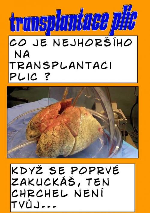  Transplantace plic 
