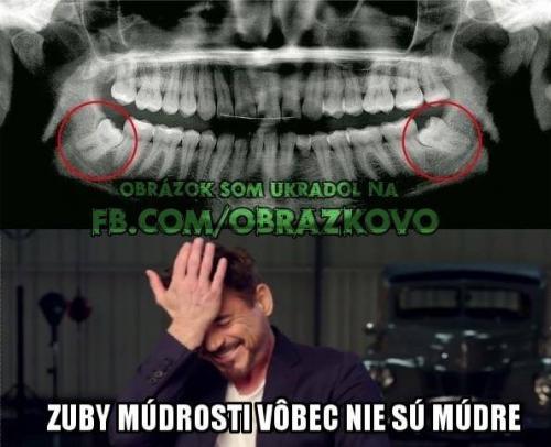  Zuby moudrosti 