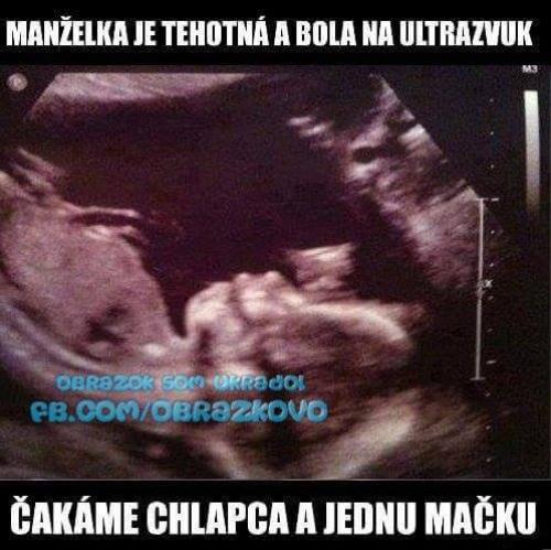  Ultrazvuk 