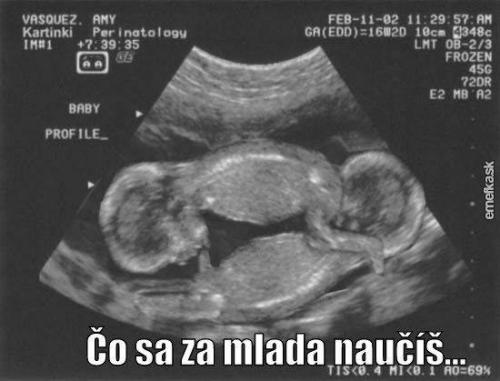 Co se naučíš