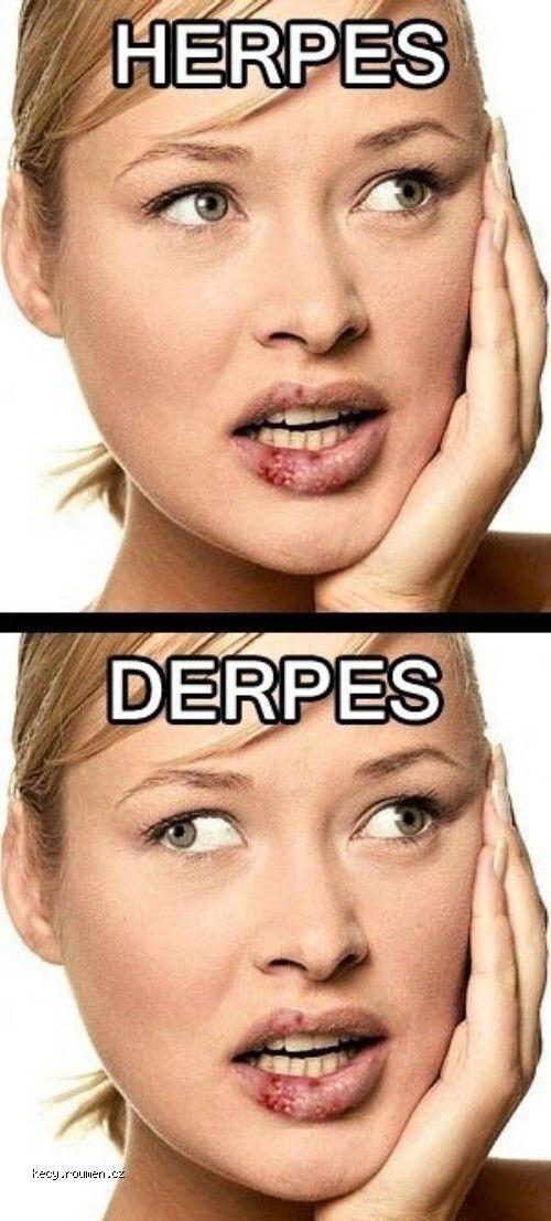 Herpes And Derpes
