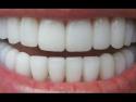  Návod - Jak na bílé zuby 