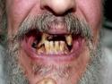       Nejčastější mýty o zubech      
