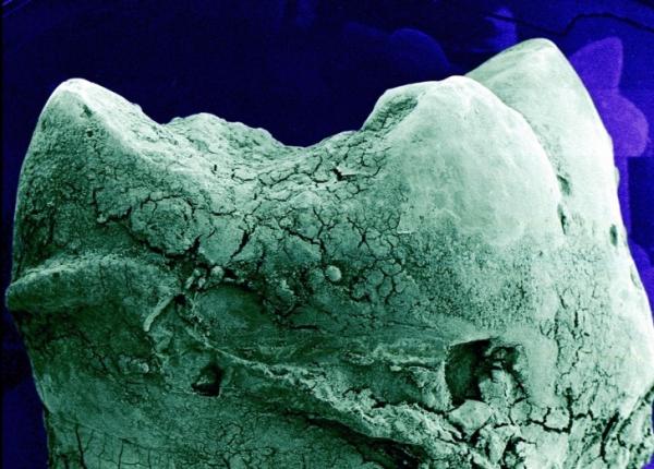       GALERIE – Jak vypadá tělo pod mikroskopem!      