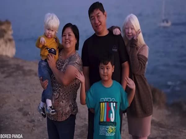       TOP 10 - Albínské děti      